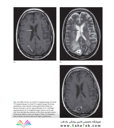 Diagnostic Imaging Armstrong 7th Edicion  2013