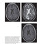 Diagnostic Imaging Armstrong 7th Edicion  2013