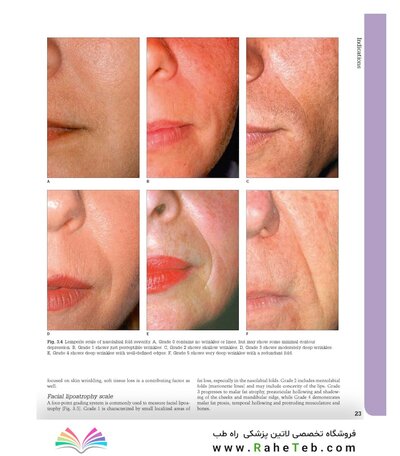 Aesthetic Plastic Surgery Video Atlas