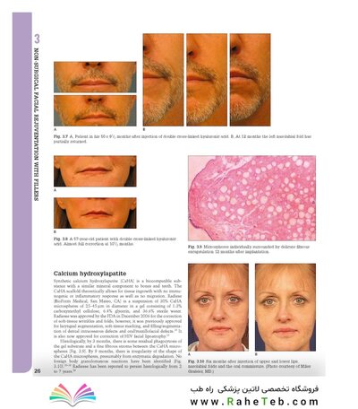 Aesthetic Plastic Surgery Video Atlas