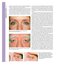 Aesthetic Plastic Surgery Video Atlas