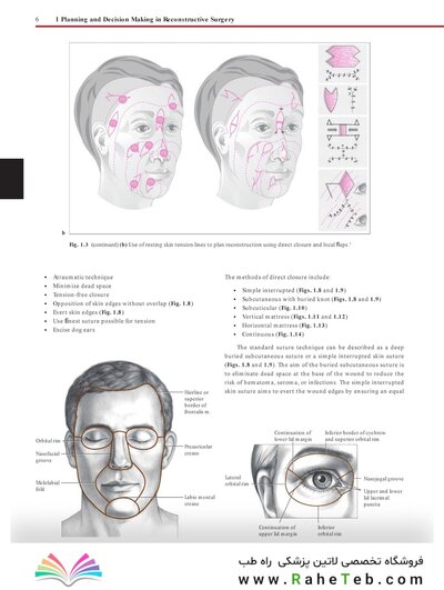 Flaps : Practical Reconstructive Surgery