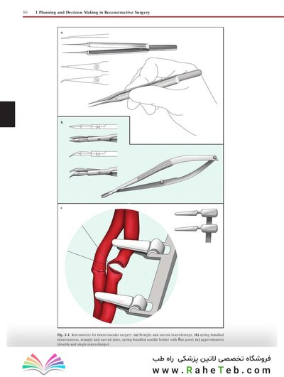 Flaps : Practical Reconstructive Surgery