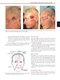Flaps : Practical Reconstructive Surgery