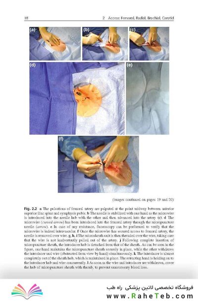 Handbook of Neuroendovascular Techniques