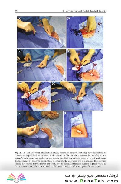 Handbook of Neuroendovascular Techniques