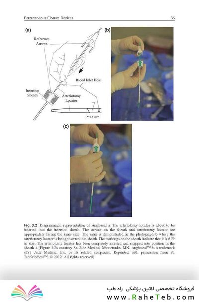 Handbook of Neuroendovascular Techniques