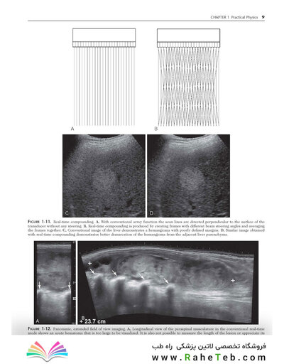 Ultrasound: The Requisites