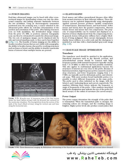 Ultrasound: The Requisites