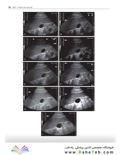 Ultrasound: The Requisites