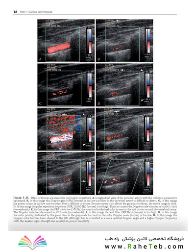 Ultrasound: The Requisites