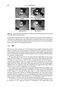 Fundamentals of Digital Image Processing : A Practical Approach with Examples in Matlab