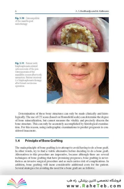Bone Management in Dental Implantology 1st ed. 2019 Edition