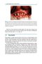 Bone Management in Dental Implantology 1st ed. 2019 Edition