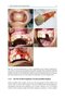 Bone Management in Dental Implantology 1st ed. 2019 Edition