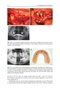 Bone Management in Dental Implantology 1st ed. 2019 Edition