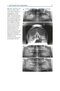 Bone Management in Dental Implantology 1st ed. 2019 Edition