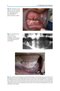 Bone Management in Dental Implantology 1st ed. 2019 Edition