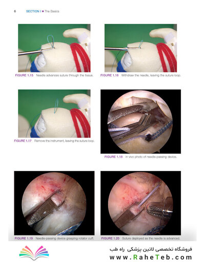 Gartsman’s Shoulder Arthroscopy 3rd Edition2018
