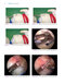 Gartsman’s Shoulder Arthroscopy 3rd Edition2018