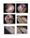 Gartsman’s Shoulder Arthroscopy 3rd Edition2018