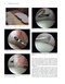 Gartsman’s Shoulder Arthroscopy 3rd Edition2018