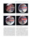 Gartsman’s Shoulder Arthroscopy 3rd Edition2018
