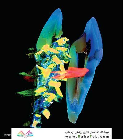 Restoring with Flowables, 1st Edition2017
