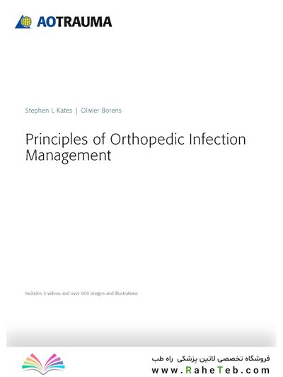 Principles of Orthopedic Infection Management2017