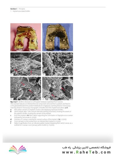 Principles of Orthopedic Infection Management2017