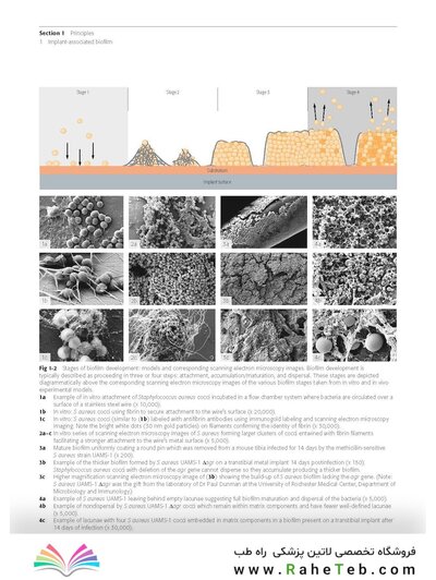 Principles of Orthopedic Infection Management2017