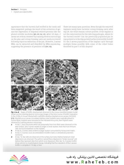 Principles of Orthopedic Infection Management2017