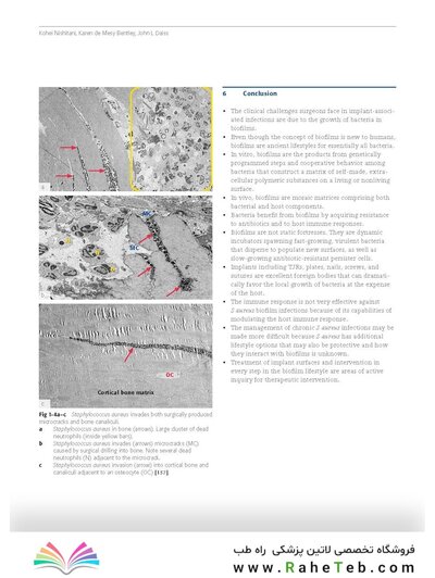 Principles of Orthopedic Infection Management2017