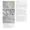 Principles of Orthopedic Infection Management2017