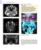 The Eye: Basic Sciences in Practice 4th Edition2015