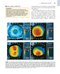 The Eye: Basic Sciences in Practice 4th Edition2015