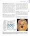 The Eye: Basic Sciences in Practice 4th Edition2015