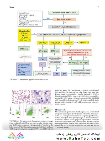 Atlas of Differential Diagnosis in Neoplastic Hematopathology2021