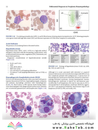 Atlas of Differential Diagnosis in Neoplastic Hematopathology2021