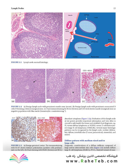 Atlas of Differential Diagnosis in Neoplastic Hematopathology2021