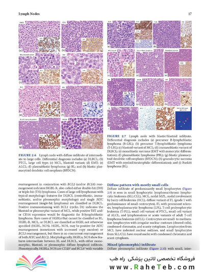 Atlas of Differential Diagnosis in Neoplastic Hematopathology2021