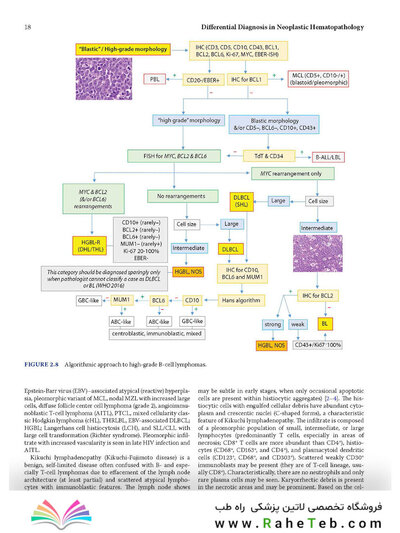 Atlas of Differential Diagnosis in Neoplastic Hematopathology2021