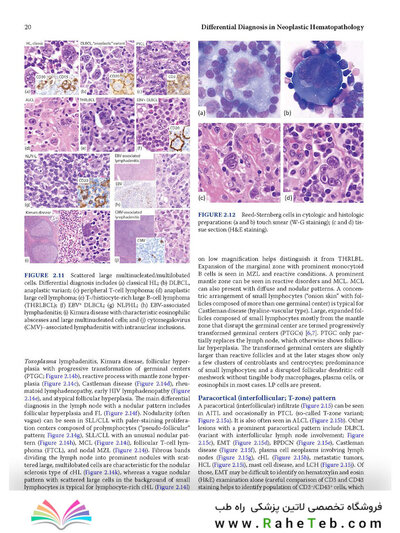 Atlas of Differential Diagnosis in Neoplastic Hematopathology2021