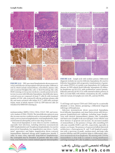 Atlas of Differential Diagnosis in Neoplastic Hematopathology2021