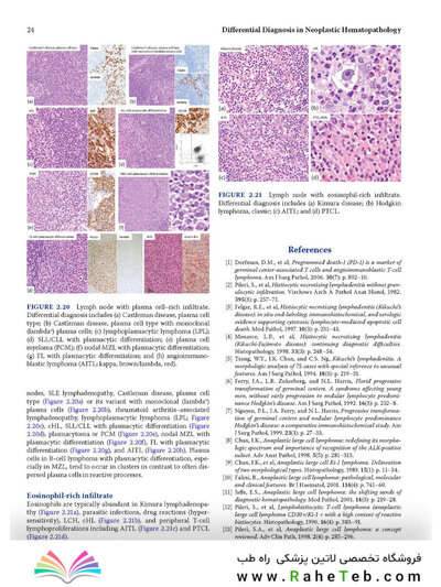 Atlas of Differential Diagnosis in Neoplastic Hematopathology2021