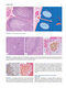 Atlas of Differential Diagnosis in Neoplastic Hematopathology2021