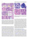 Atlas of Differential Diagnosis in Neoplastic Hematopathology2021