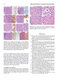 Atlas of Differential Diagnosis in Neoplastic Hematopathology2021