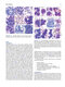 Atlas of Differential Diagnosis in Neoplastic Hematopathology2021