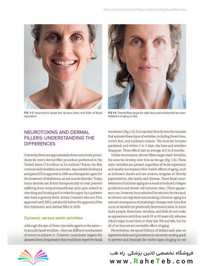 Dermal Fillers for Dental Professionals